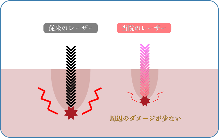 レーザー周囲のダメージが少ない図