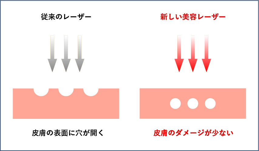 皮膚のダメージが少ない画像